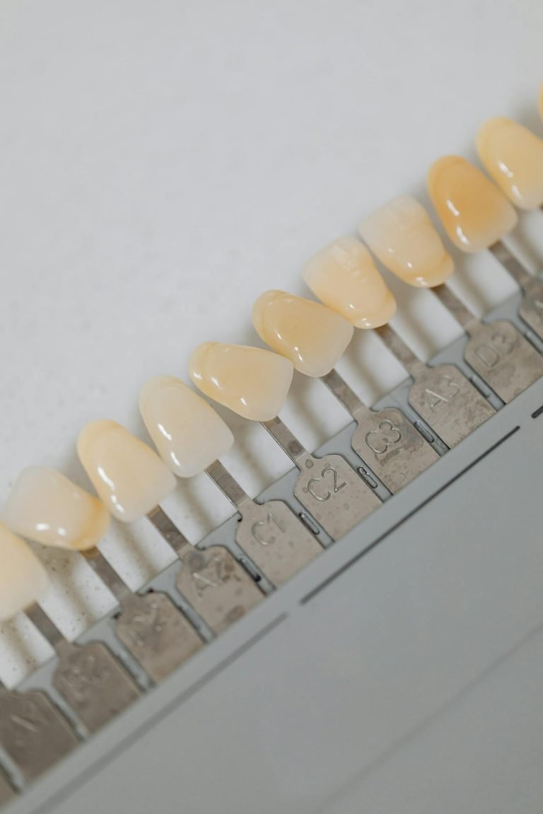 Close-up of a dental shade guide illustrating various tooth color options for dental procedures.